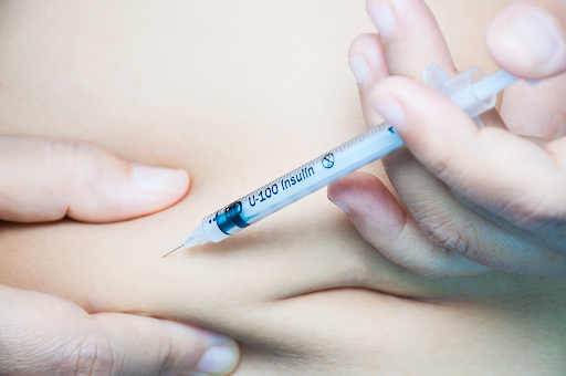Epidural Steroid Shot Epidural Steroid Shot